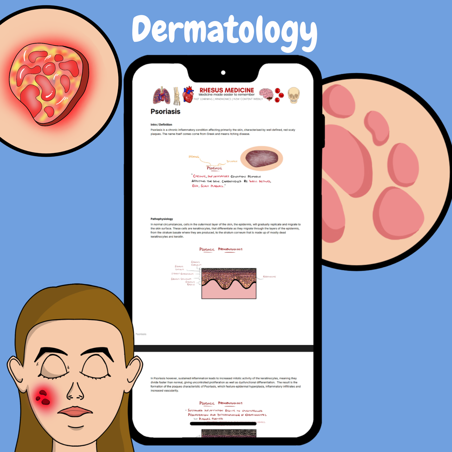 Dermatology