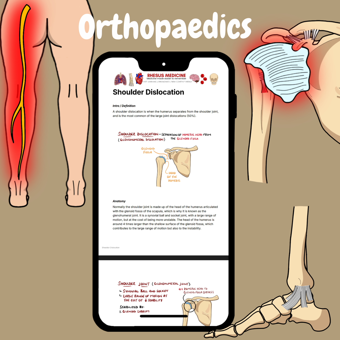 Orthopaedics
