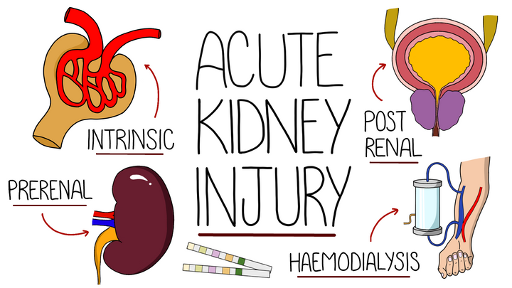 Acute Kidney Injury