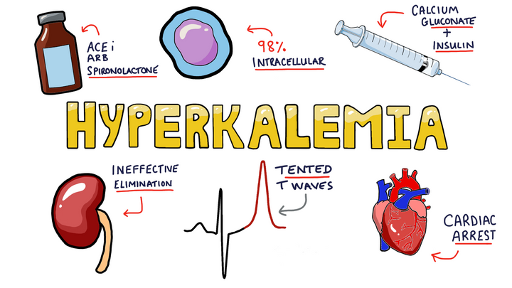 Hyperkalemia