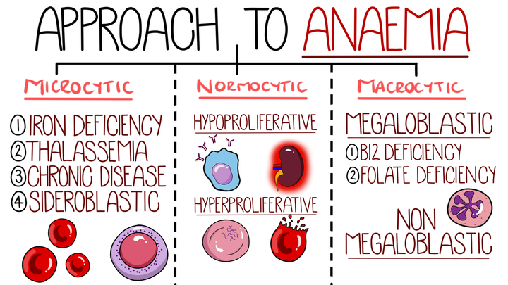 An Approach to Anaemia