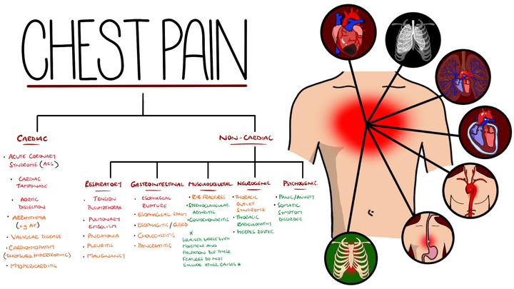 Approach to Chest Pain