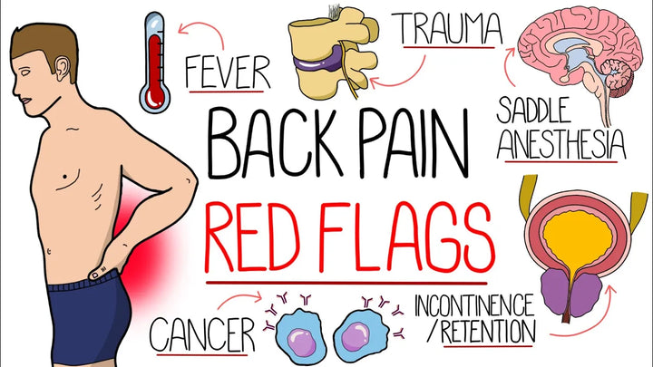 Mnemonic - Red Flags for Back Pain