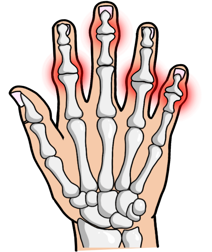 Everything in Rheumatology 