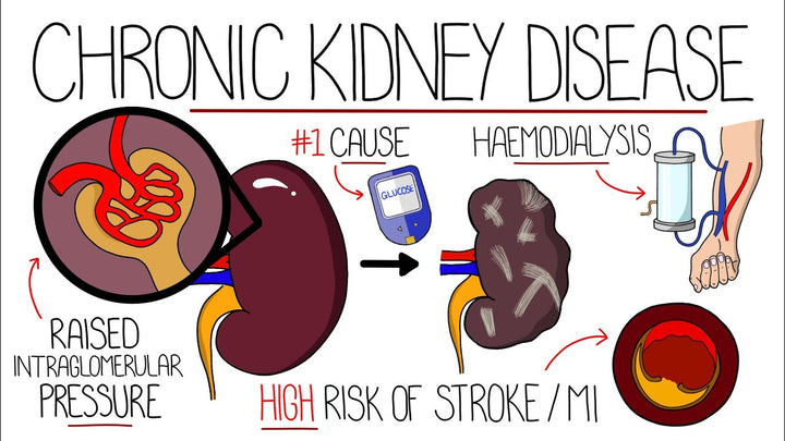 Chronic Kidney Disease