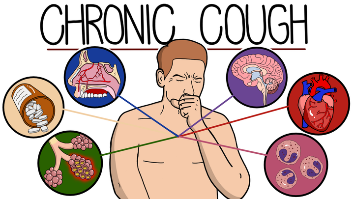 Chronic Cough Causes and Management