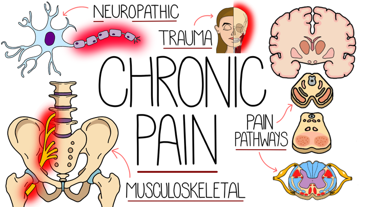 Chronic Pain