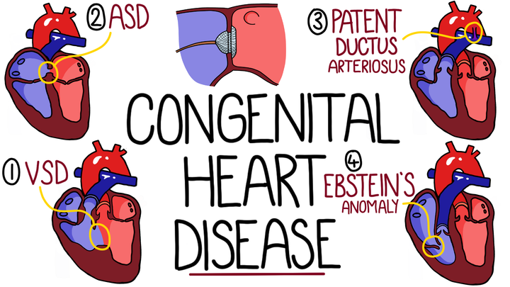Congenital Heart Disease