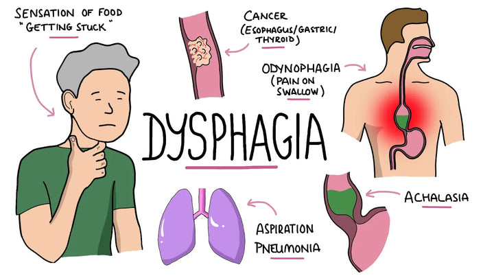 Dysphagia