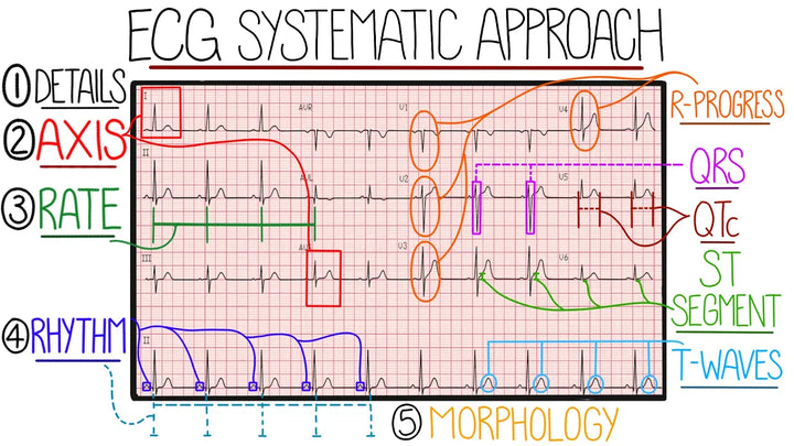 ECG Interpretation Made Easy - Systematic Approach