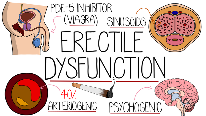 Erectile Dysfunction