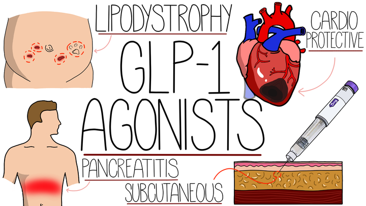 GLP-1 Agonists