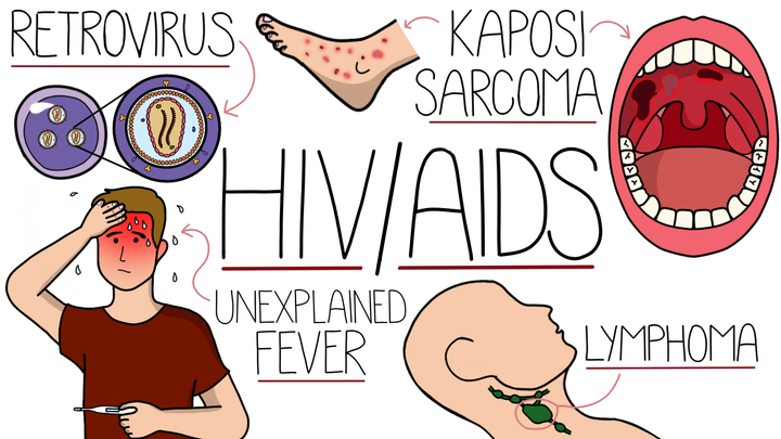 HIV/AIDS