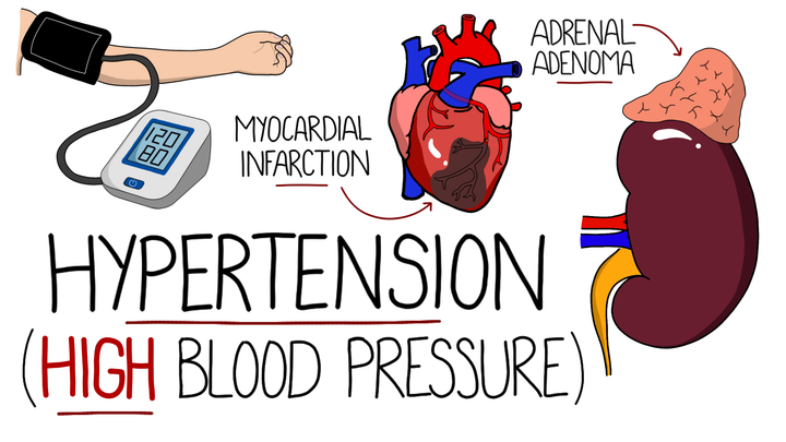 Hypertension