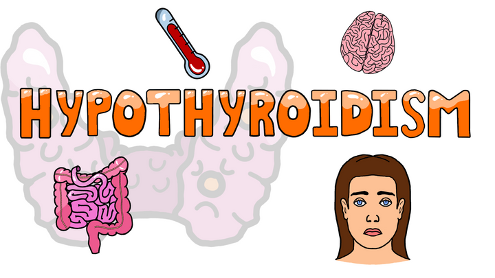 Mnemonic - Symptoms of Hypothyroidism 