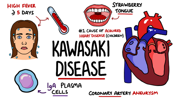 Kawasaki Disease