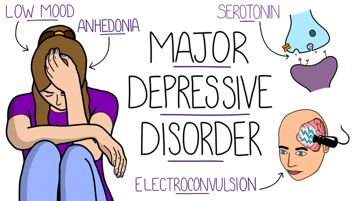 Major Depressive Disorder