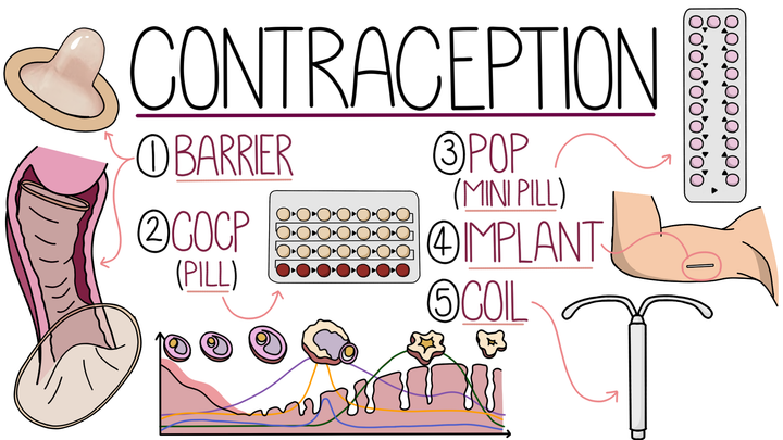 Contraception 