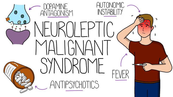 Neuroleptic Malignant Syndrome
