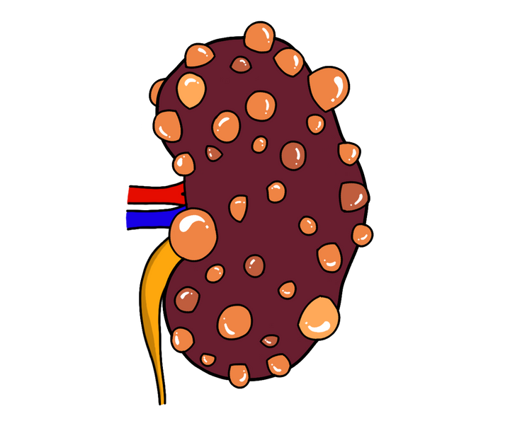 Everything in Nephrology