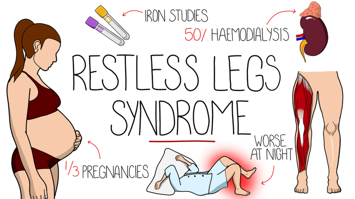 Restless Leg Syndrome