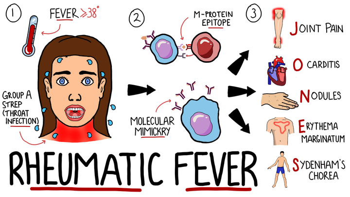 Rheumatic Fever
