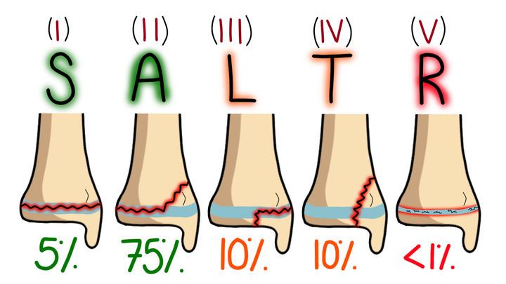 Salter-Harris Classification
