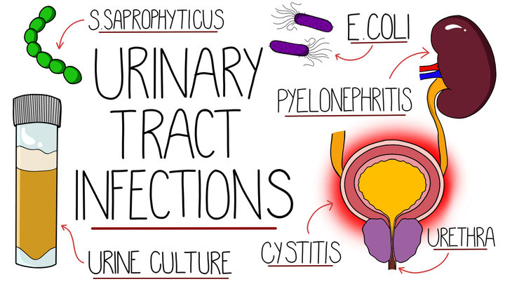 Urinary Tract Infections
