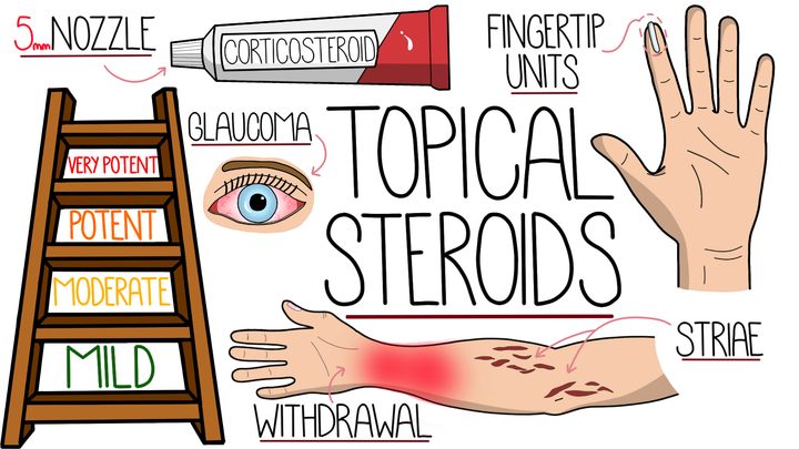 Topical Steroid Potency