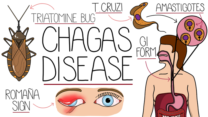 Chagas Disease