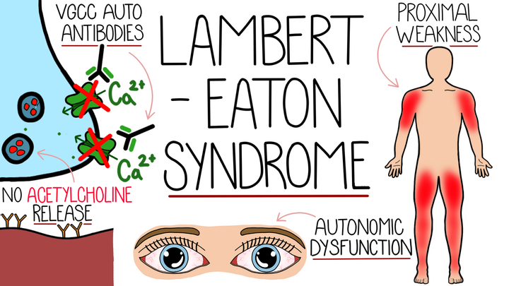 Lambert Eaton Myasthenic Syndrome