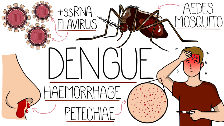 Dengue Fever