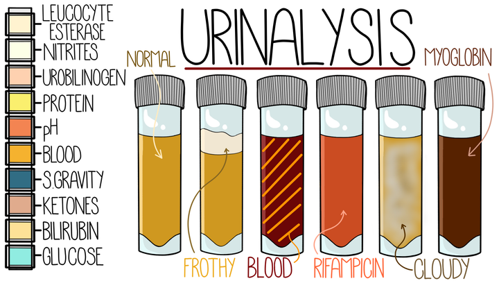 Urinalysis Interpretation