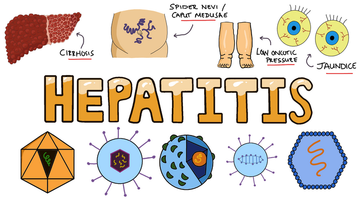 Hepatitis - General & Comparison